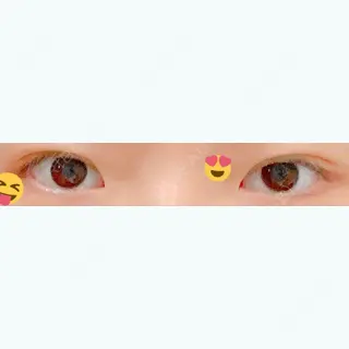 10日目の経過画像（2枚目）