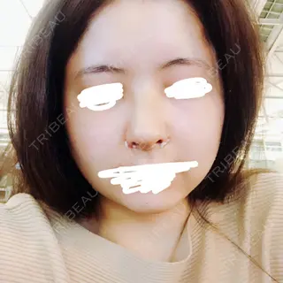 6日目の経過画像（1枚目）
