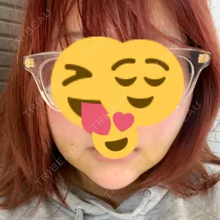 5日目の経過画像（1枚目）