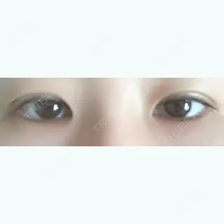 23日目の経過画像（1枚目）