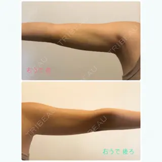 8日目の経過画像（2枚目）