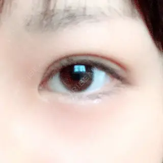 27日目の経過画像（3枚目）