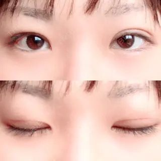 27日目の経過画像（1枚目）