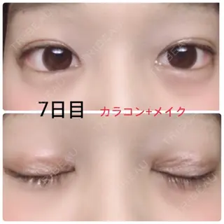 7日目の経過画像（1枚目）
