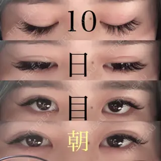 9日目の経過画像（1枚目）