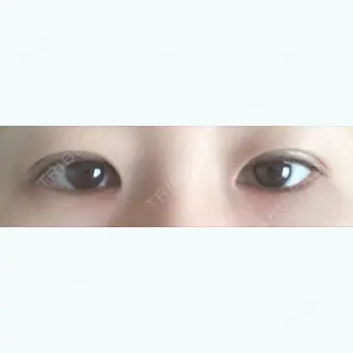 24日目の経過画像（1枚目）