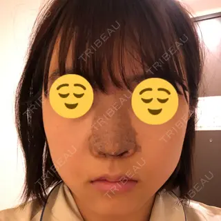 3日目の経過画像（1枚目）