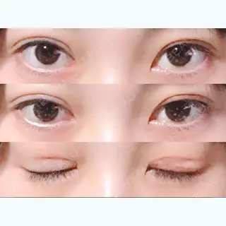 12日目の経過画像（1枚目）
