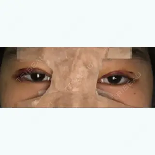 2日目の経過画像（1枚目）