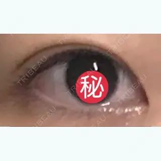 47日目の経過画像（1枚目）