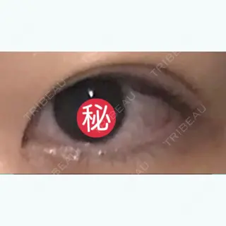 47日目の経過画像（2枚目）