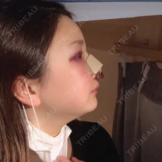 3日目の経過画像（2枚目）