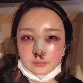 3日目の経過画像（1枚目）