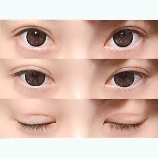 14日目の経過画像（1枚目）