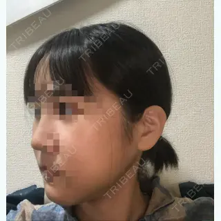 19日目の経過画像（2枚目）