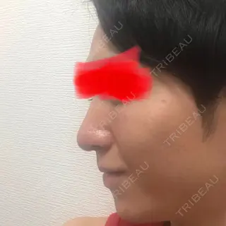 8日目の経過画像（2枚目）
