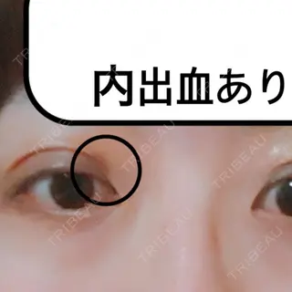 10日目の経過画像（3枚目）