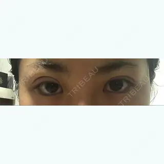 3日目の経過画像（1枚目）