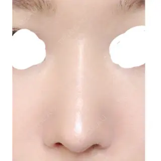 24日目の経過画像（1枚目）