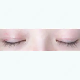 16日目の経過画像（3枚目）