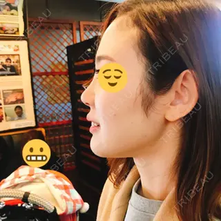 1日目の経過画像（1枚目）