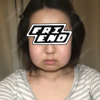 0日目の経過画像（1枚目）