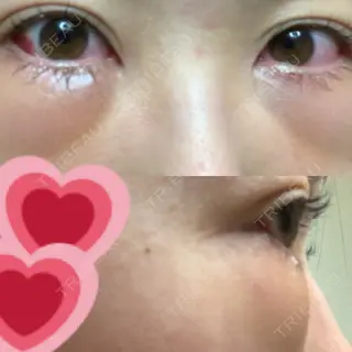 1日目の経過画像（1枚目）