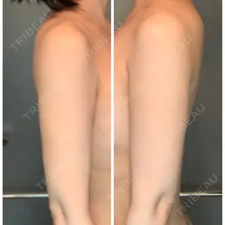 7日目の経過画像（1枚目）