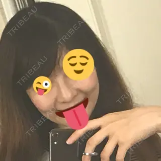 180日目の経過画像（1枚目）