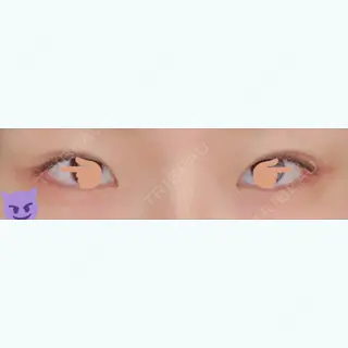 29日目の経過画像（1枚目）