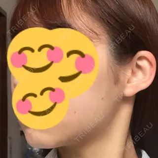 4日目の経過画像（3枚目）