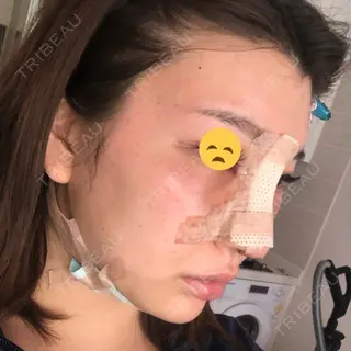 2日目の経過画像（2枚目）