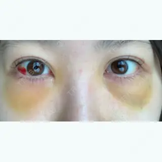 3日目の経過画像（1枚目）