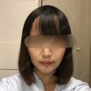 53日目の経過画像（1枚目）