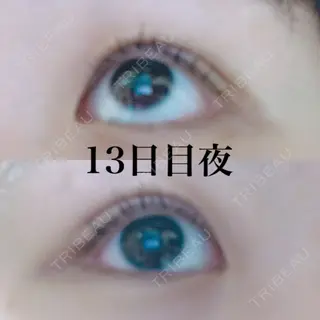13日目の経過画像（1枚目）