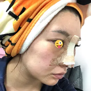 2日目の経過画像（2枚目）