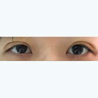 3日目の経過画像（1枚目）