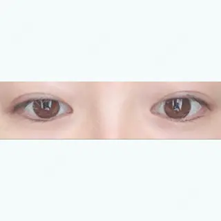 20日目の経過画像（2枚目）