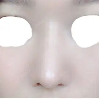 26日目の経過画像（1枚目）