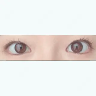 21日目の経過画像（2枚目）