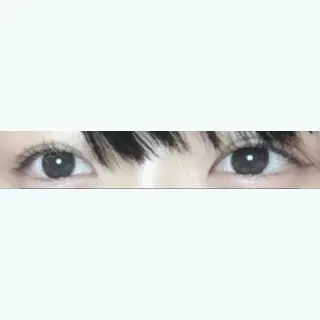33日目の経過画像（1枚目）