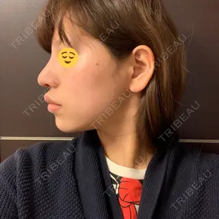 9日目の経過画像（2枚目）