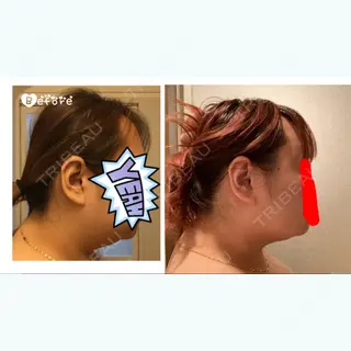 79日目の経過画像（1枚目）