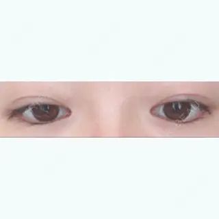 24日目の経過画像（2枚目）