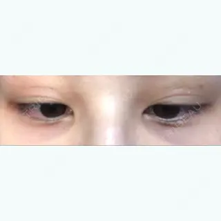 8日目の経過画像（2枚目）