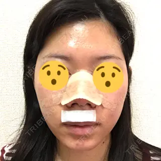 1日目の経過画像（1枚目）
