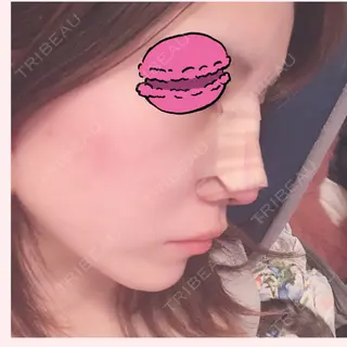 3日目の経過画像（1枚目）