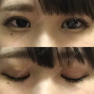 5日目の経過画像（2枚目）