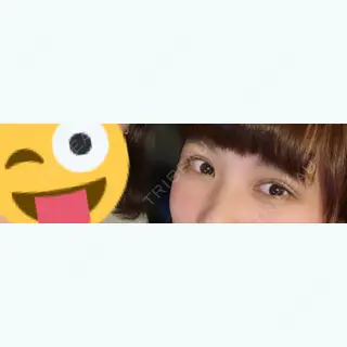 23日目の経過画像（2枚目）