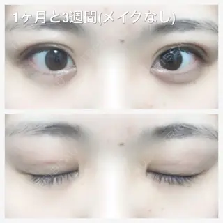 49日目の経過画像（1枚目）